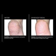 Load image into Gallery viewer, PCA Skin  |  Body Therapy
